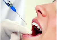 Does a Root Canal hurt?