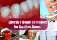 SoreInflamed Gums Pain Relief Home Remedies